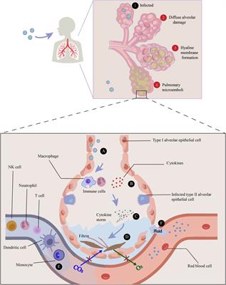 One stone two birds: anti-inflammatory bronchodilators as a potential pharmacological strategy for COVID-19